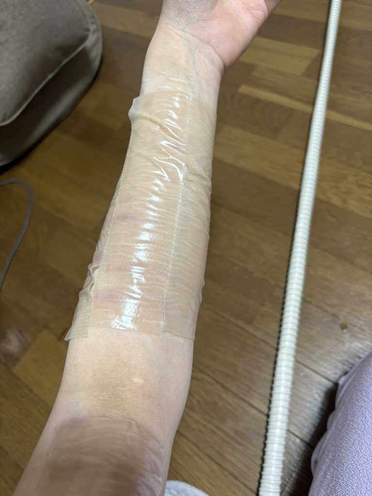 リスカ跡治療記録 tweet media