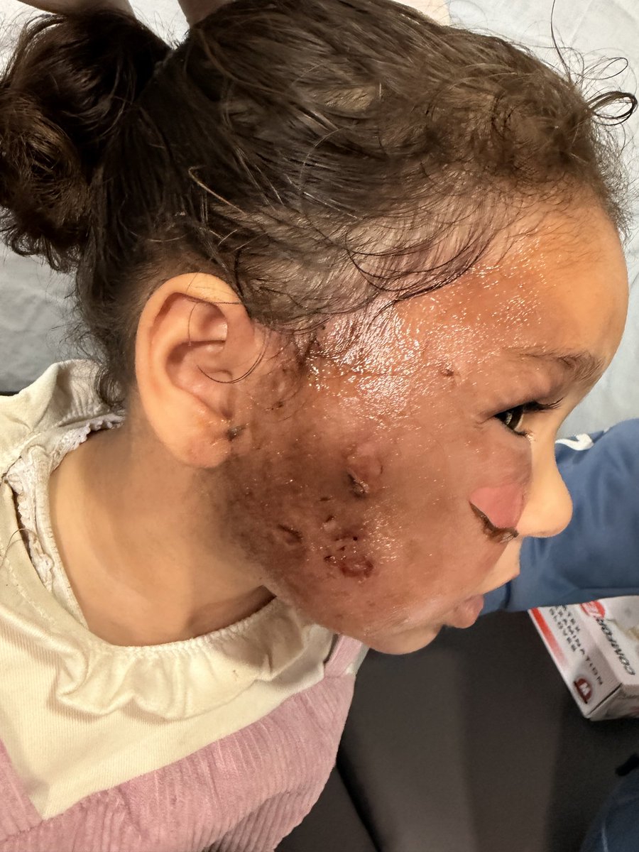 Dr. Ezzideen tweet media