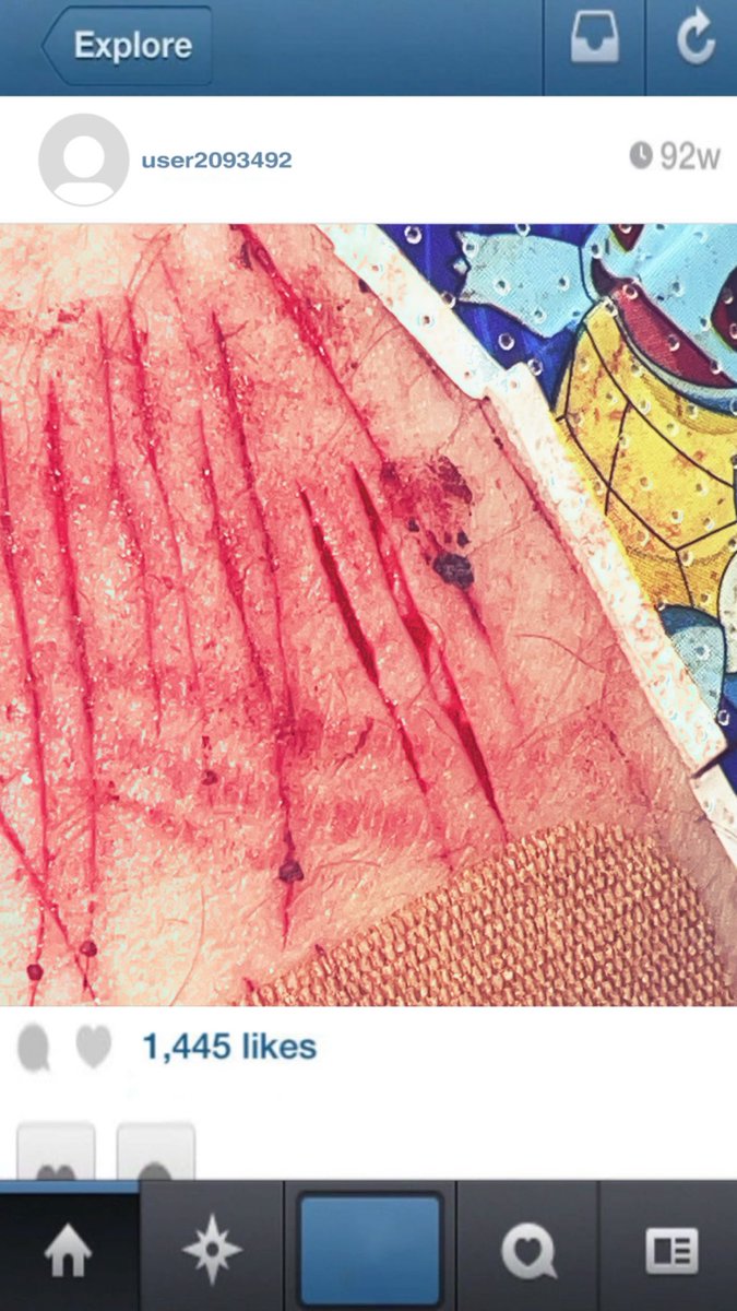 Ch4micalz's tweet photo. NOT REAL NOT REAL SFX MAKEUP!! #shtwt #shedtwt #slashtwt https://t.co/8rb595qI6O