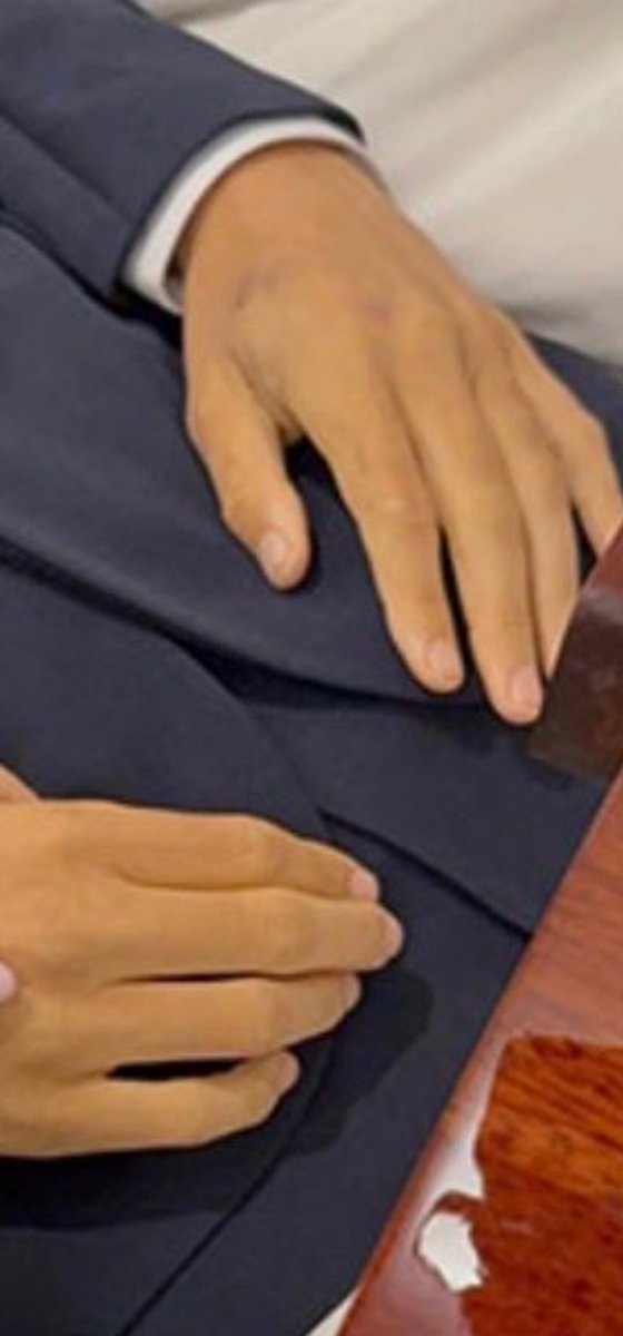 kell4's tweet photo. @martinez_j7902 @thematrixb0t What are the marks on his hand from? https://t.co/WsQHJrxJ7o