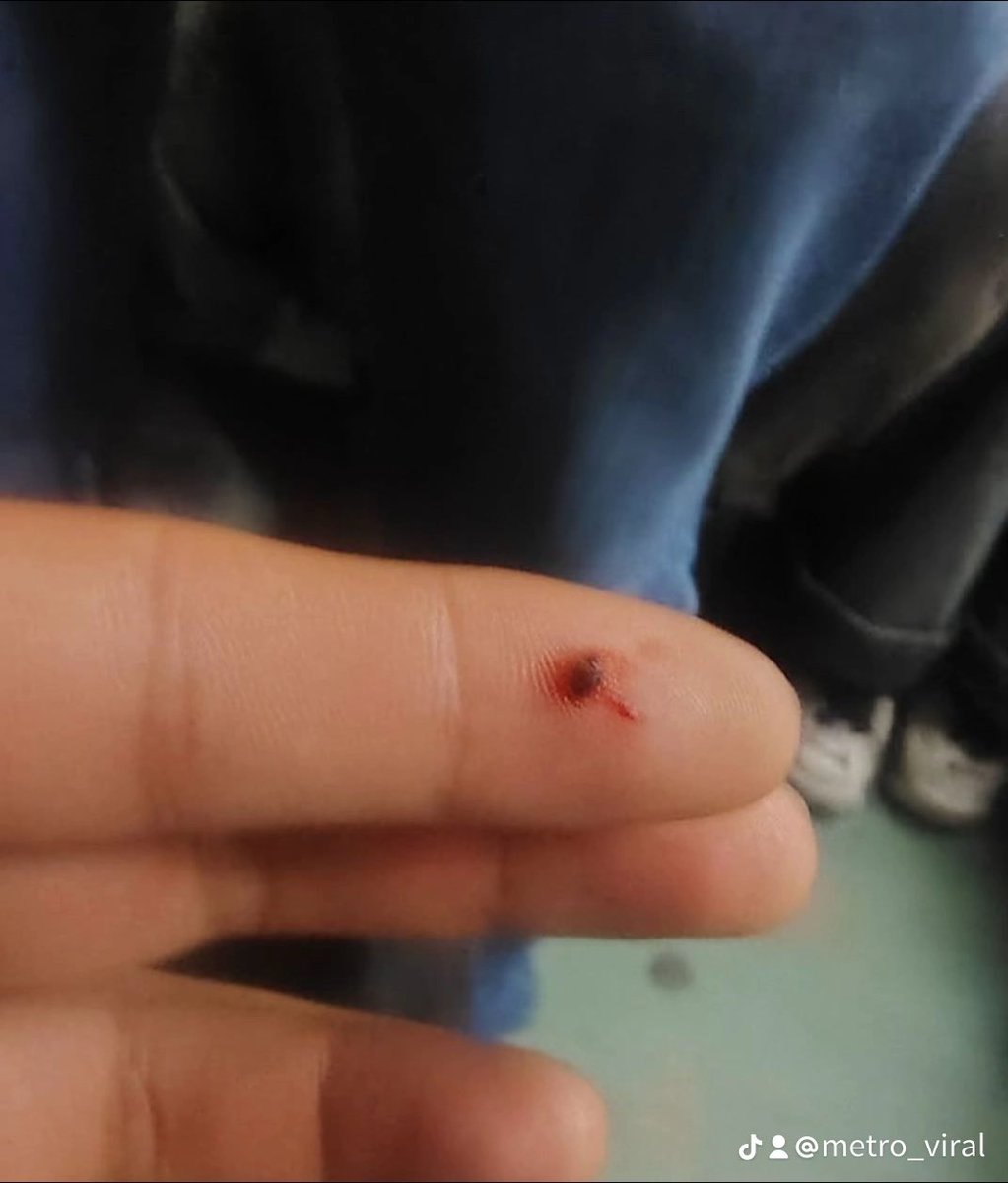 MetroViralMx's tweet image. #ULTIMAHORA

Usuarios reportan brote de chinches en el Metro Ciudad de México 🇲🇽 @MetroCDMX 

El #MetroCDMX está cada vez peor❌

El Usuario se deshizo del insecto una vez qué sintió que caminaba por su brazo…⚠️