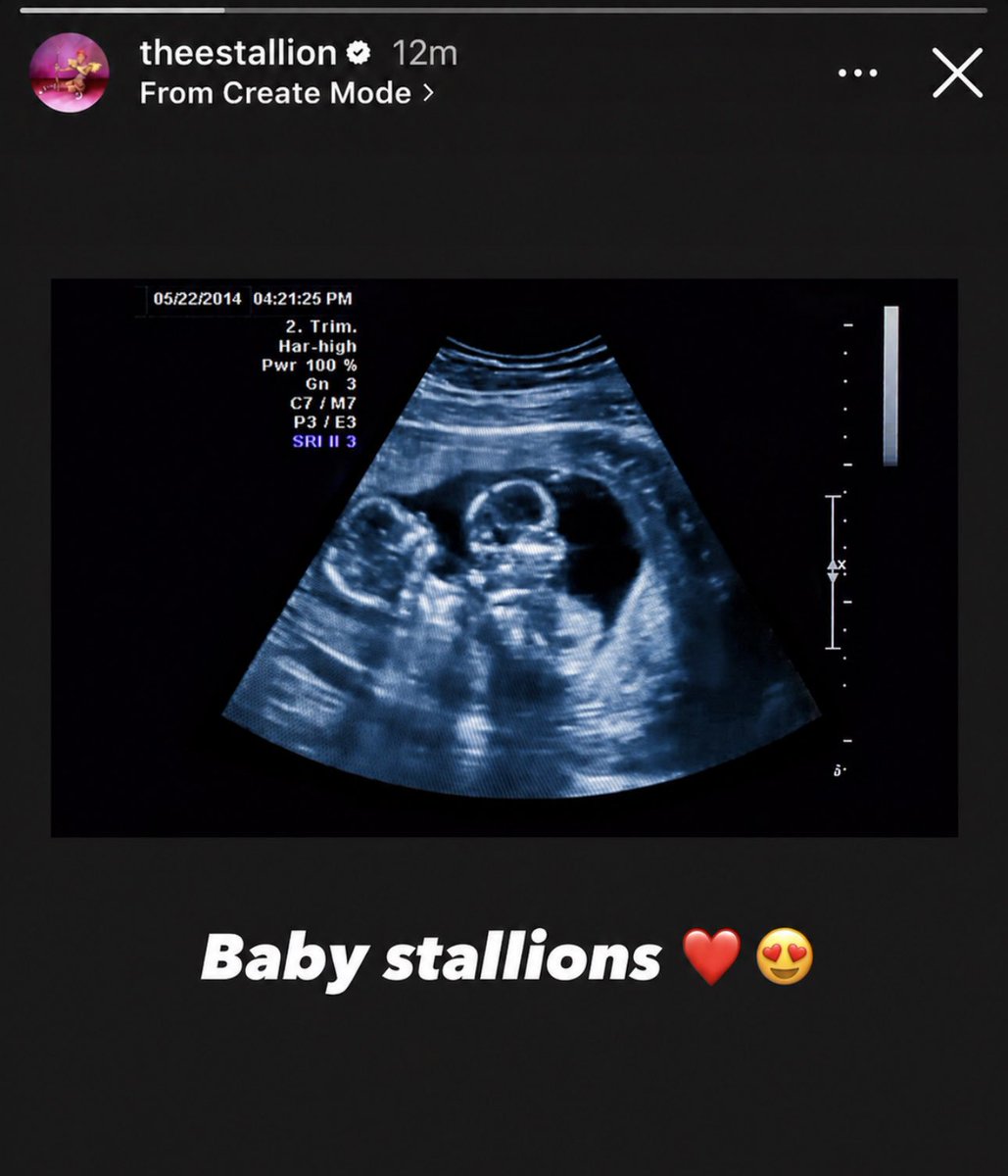 Megan Thee Stallion announces that she is pregnant with twins.

She shared an ultrasound and a photo captioned "Baby stallions."