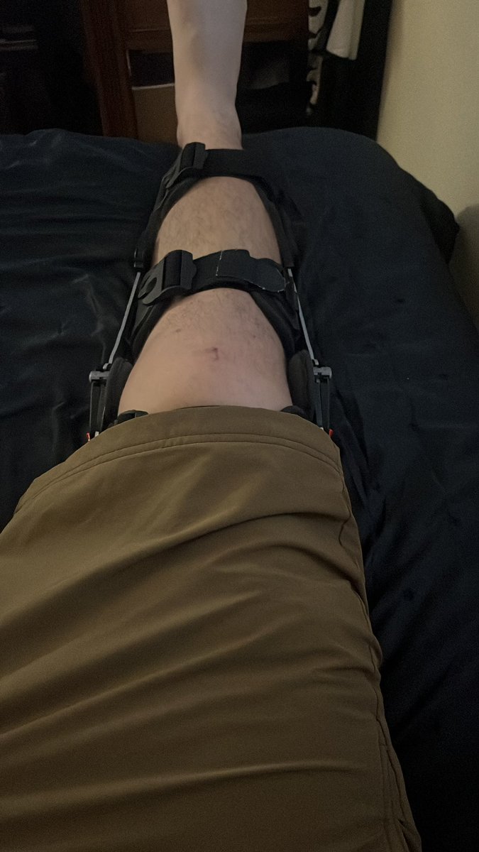 702HyPER702's tweet photo. @RichardOsb48449 @HoodieYo8 @LegionHoops That doesn’t mean anything. Tore my ACL and meniscus and was walking afterward. Even put up a couple shots. Speaking from experience https://t.co/78rWy8QcTi