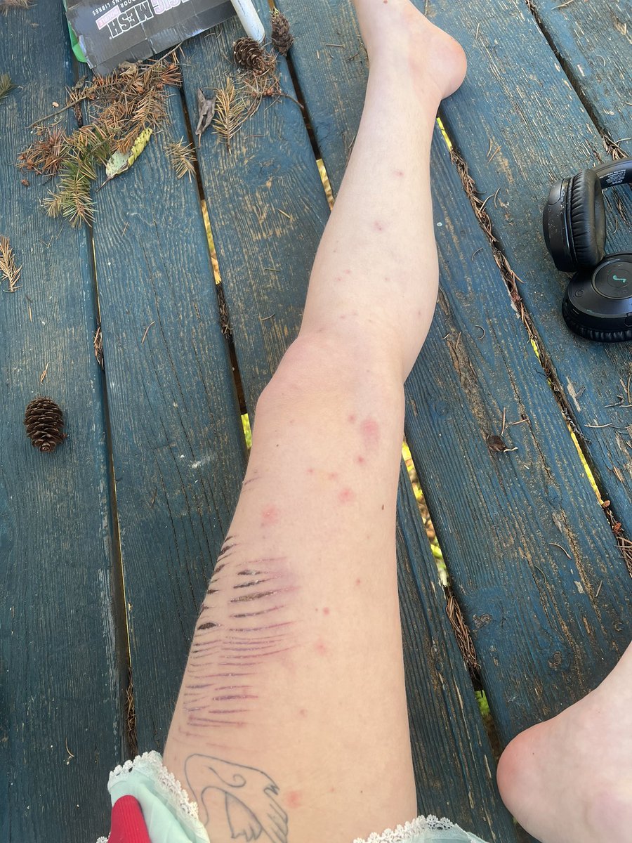 bunny luvr tweet media