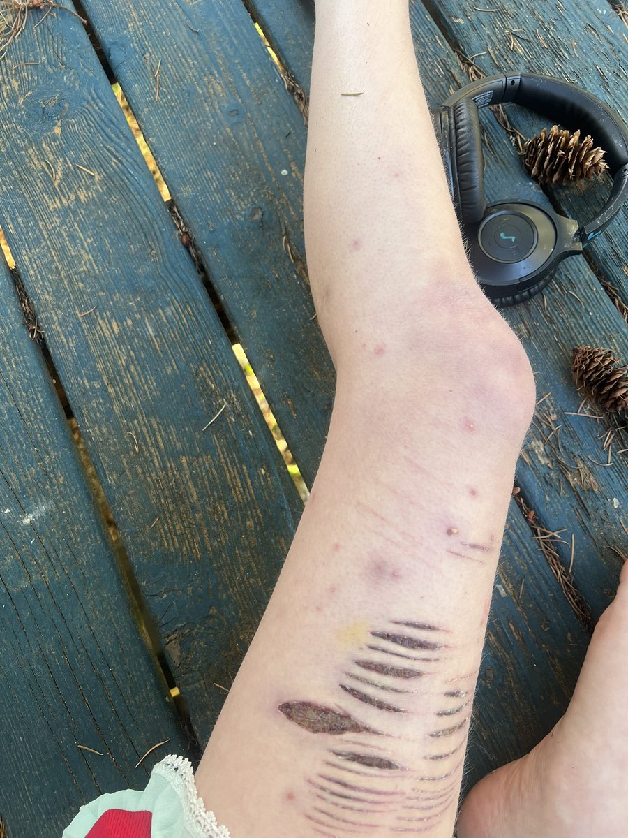 bunny luvr tweet media