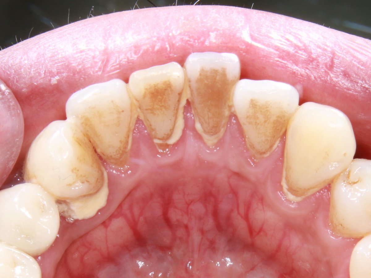 itaru_yoshida tweet media