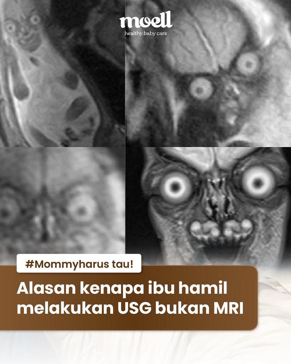 Zona Store tweet media