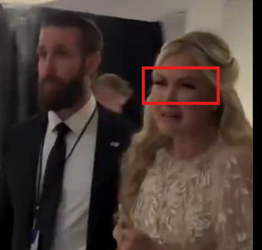 tinf0ilPsy0p tweet media