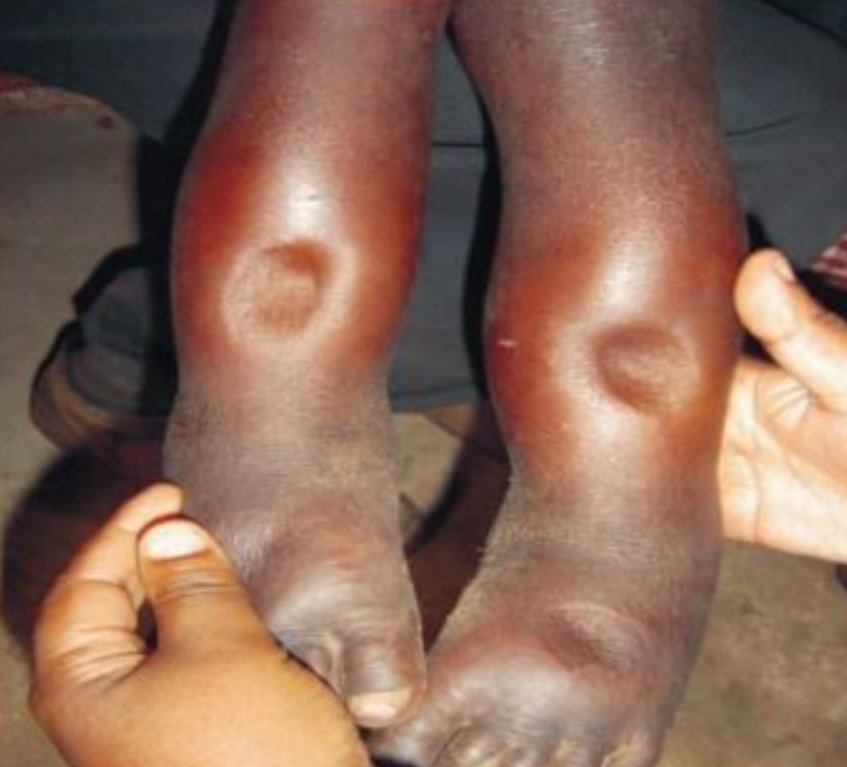 Dr. Priyam Bordoloi tweet media