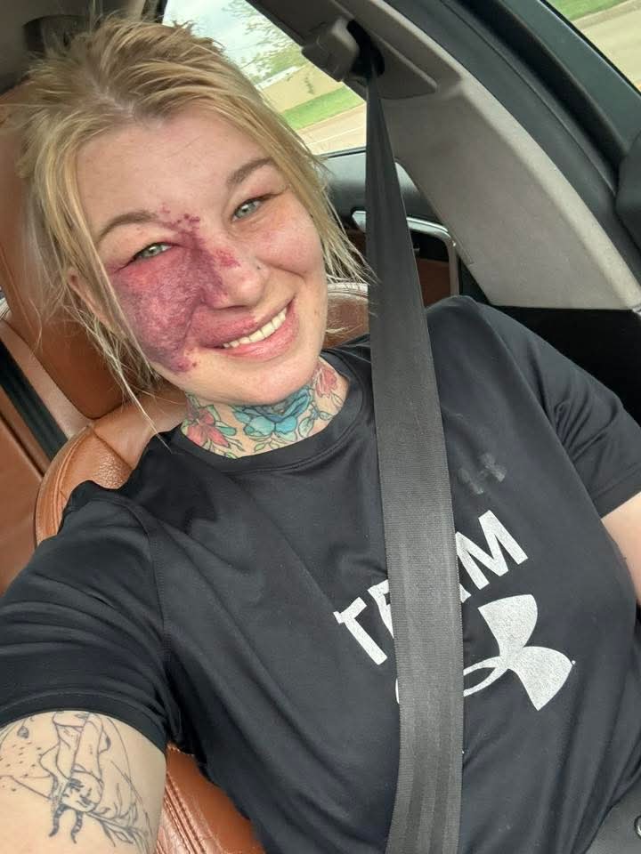 SarahKhan463's tweet image. Let’s start this week off right I hope nothing but positivity and blessings for you 💚 

#NaturalBeauty #birthmarkmodel #beyourself #nomakeup #fypシ #fypシ゚viralシ