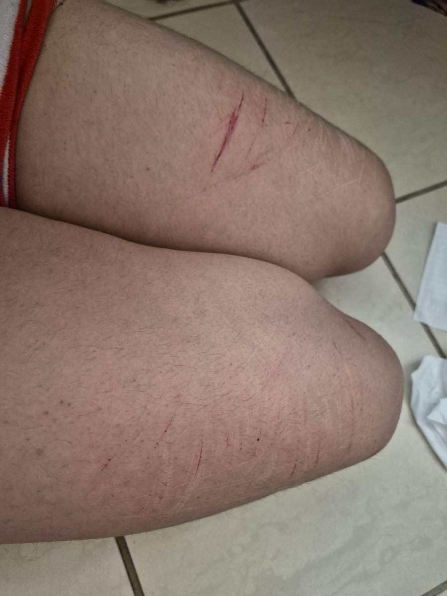 𝔐𝔞𝔯𝔰𝔢𝔦𝔩𝔩𝔢 #shedtwt tweet media