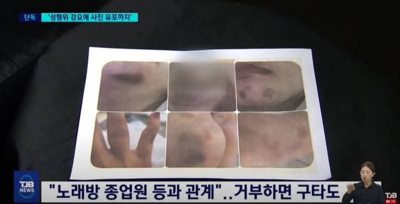 국민의힘에서 성착취 문제가 터졌는데 역시나 세상은 조용합니다.

국민의힘이 하면 침묵하는 일이 반복되고 있는 겁니다.