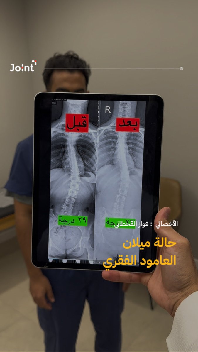 Jointclinic_sa's tweet photo. قصة نجاح مع حالة ( ميلان وانحراف في العمود
الفقري ) الجنف وعلاجها في عيادات جوينت بإشراف وخطة علاجية طبية بأفضل المعايير وآخر
الدراسات الطبية 👌💙
مع الاخصائي المميز: @fawaz_physio 

#علاج_طبيعي #عيادات_جوينت  #الجنف https://t.co/Cl9CTJecOp