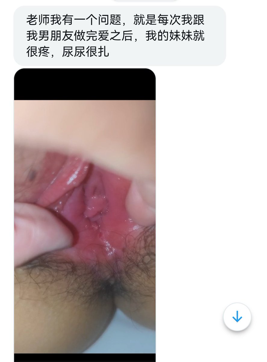 TherapistGreen_'s tweet photo. 【性解惑】
1，会阴处（阴道口下方）是最容易在性交时开裂的地方，而且伤口愈合后皮肤的弹性会变差，下一次更容易在同样区域裂开，性交时不但要注意润滑，更要由慢到快，多给阴道一些适应的时间
2，阴道高潮相关内容可以查看之前的专题贴 https://t.co/xkGbT1cg2f