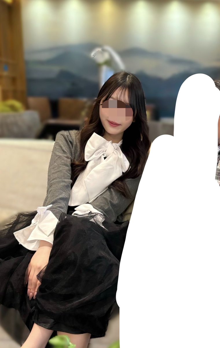 y2lu_'s tweet photo. 頬・顎下脂肪吸引レポ 術後3ヶ月後

角度異なっていて申し訳ない🫠けど圧倒的に写真が盛れるようになったT_T💘

#整形垢さんと繋がりたい
#脂肪吸引 https://t.co/tzWW1xx836