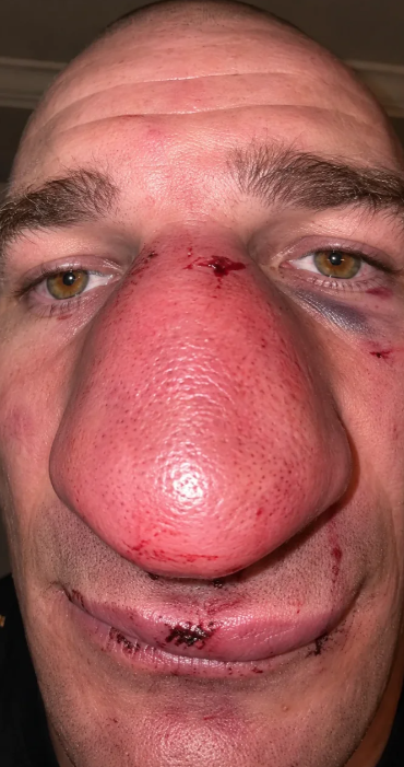 MMA FIXED tweet media