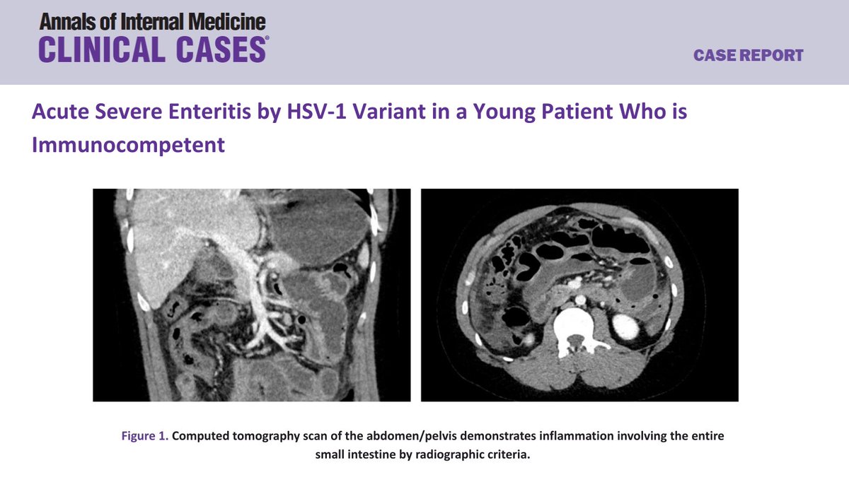 Annals of Internal Medicine: Clinical Cases tweet media