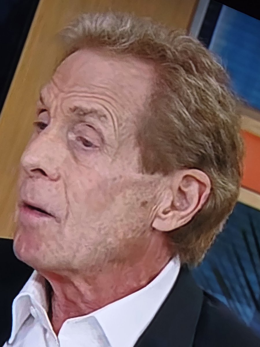 btbaker86's tweet photo. @RealSkipBayless you look like your on your last leg. This makeup looks horrible. You look like the end of a pimple. https://t.co/Fx8H74apr1