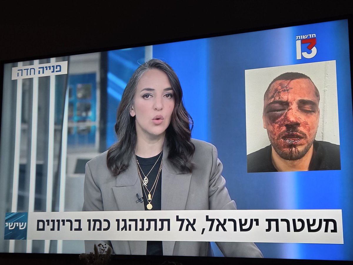 השוטר החלאה שעשה את זה כבר נעצר?
מזעזע. מחריד.