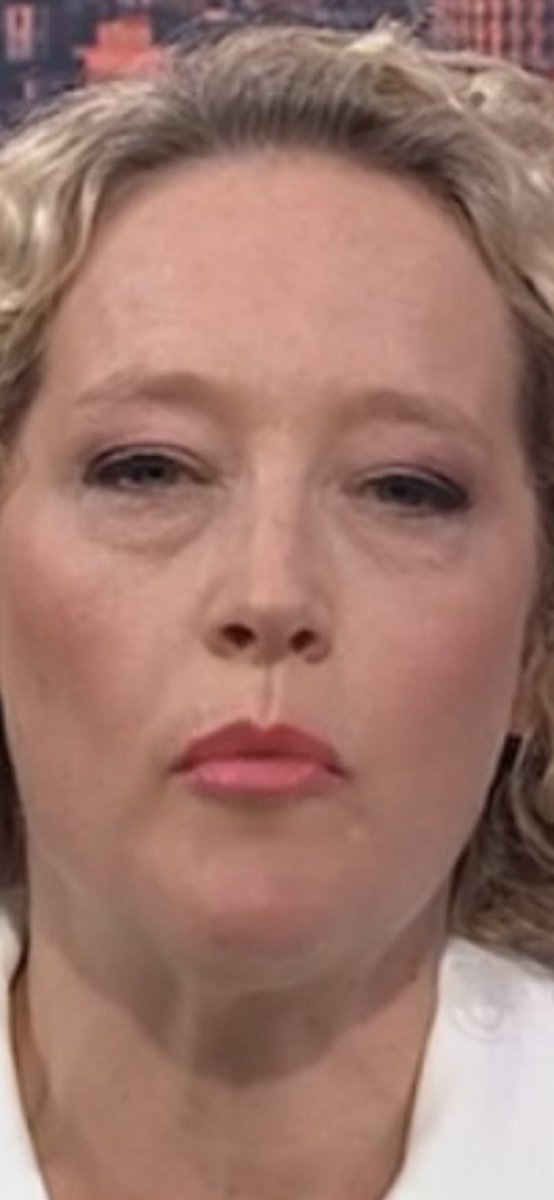 JOSEPHDOYL39373's tweet photo. @SkyNews you looked good in the advert for your new show but look at your face have you had a fight and watching you after Sophie your rubbish …..too much drinking or maybe you been in a fight cmon sky buck up is that a bit of a black eye ????? Rubbish argumentative and boring https://t.co/VQs5R13PqW