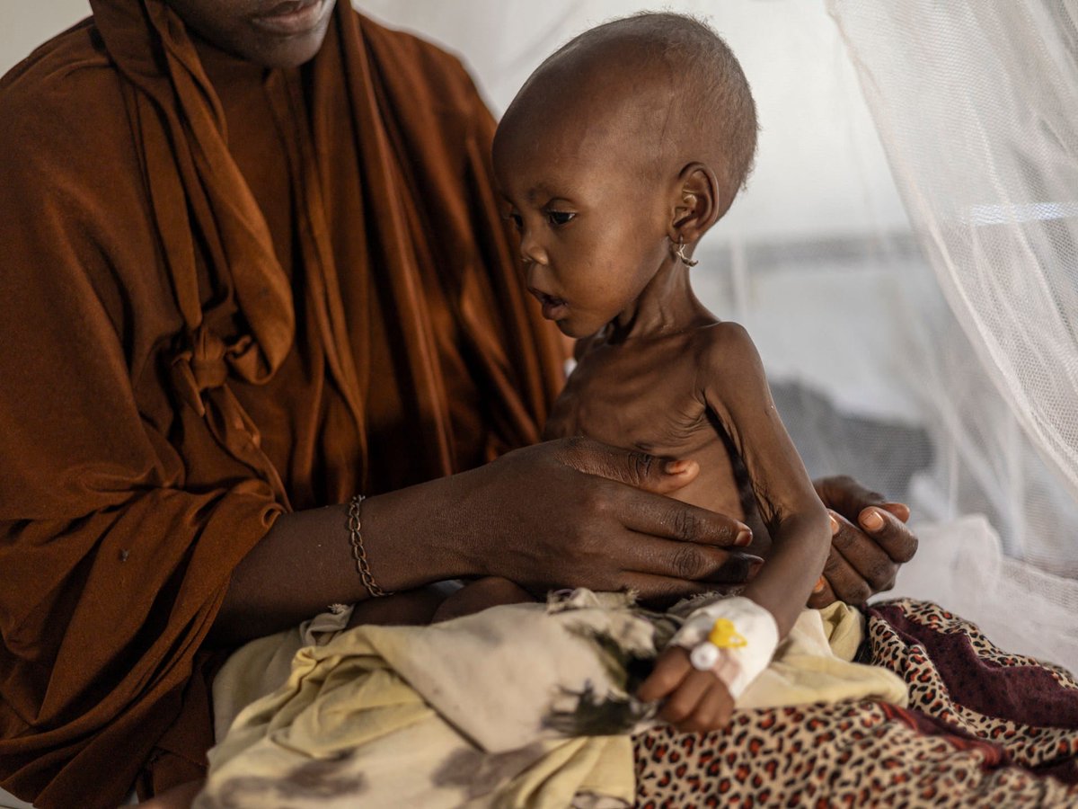 AbayTimes's tweet photo. Over 300,000 Somalis have fled their homes since January due to a lethal mix of drought and conflict. The humanitarian crisis deepens as aid cuts force camps in Kismayo to struggle with a surge of displaced families. Conditions are dire, with malnutrition cases tripling. https://t.co/LVxxKIOAV6