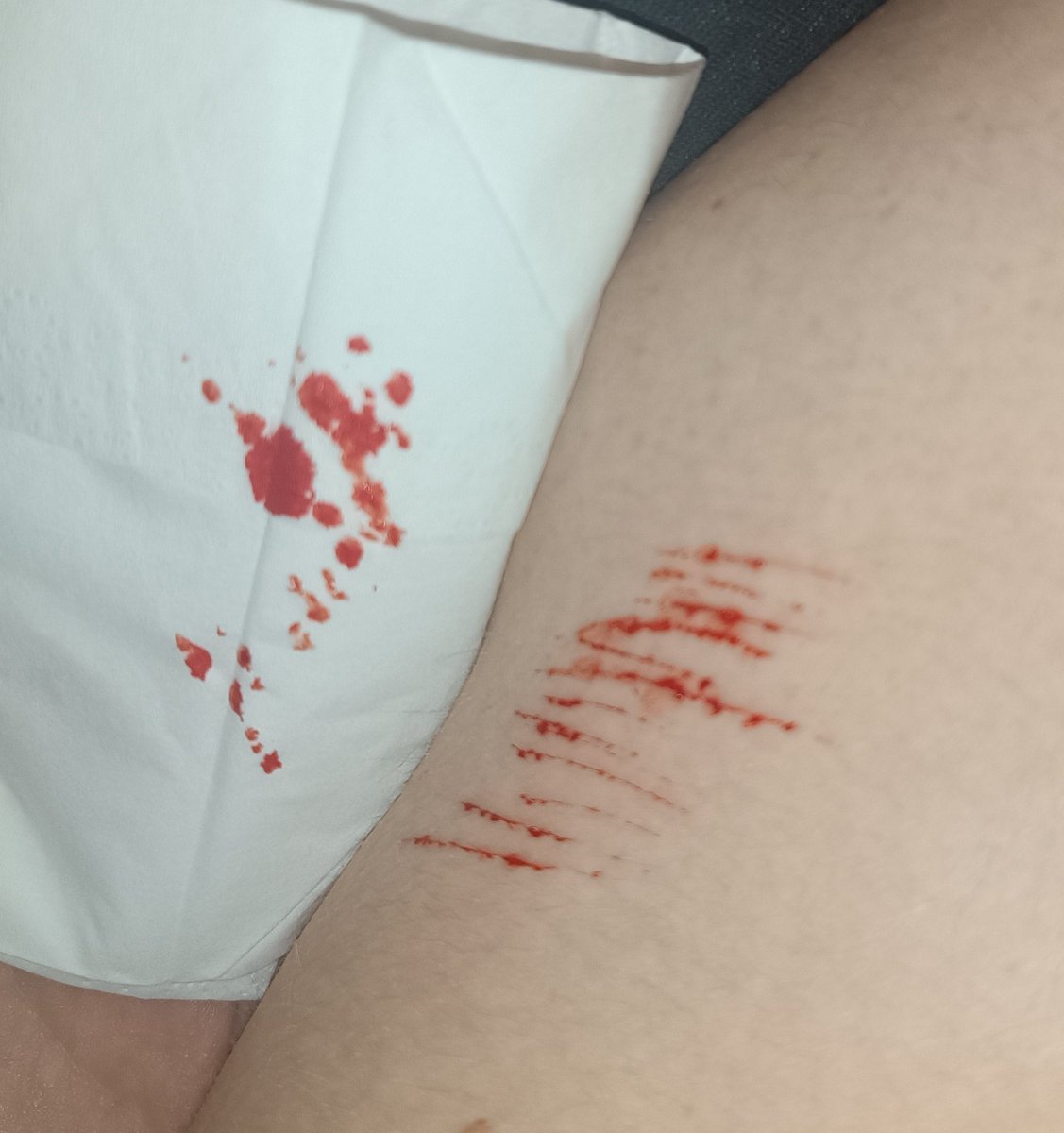 mattyb4ckup's tweet photo. "how do u cope after a binge?"
well
#shwtwt #shedtwt https://t.co/cuP4kYpWWM