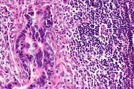 Intestinal Cell News tweet media