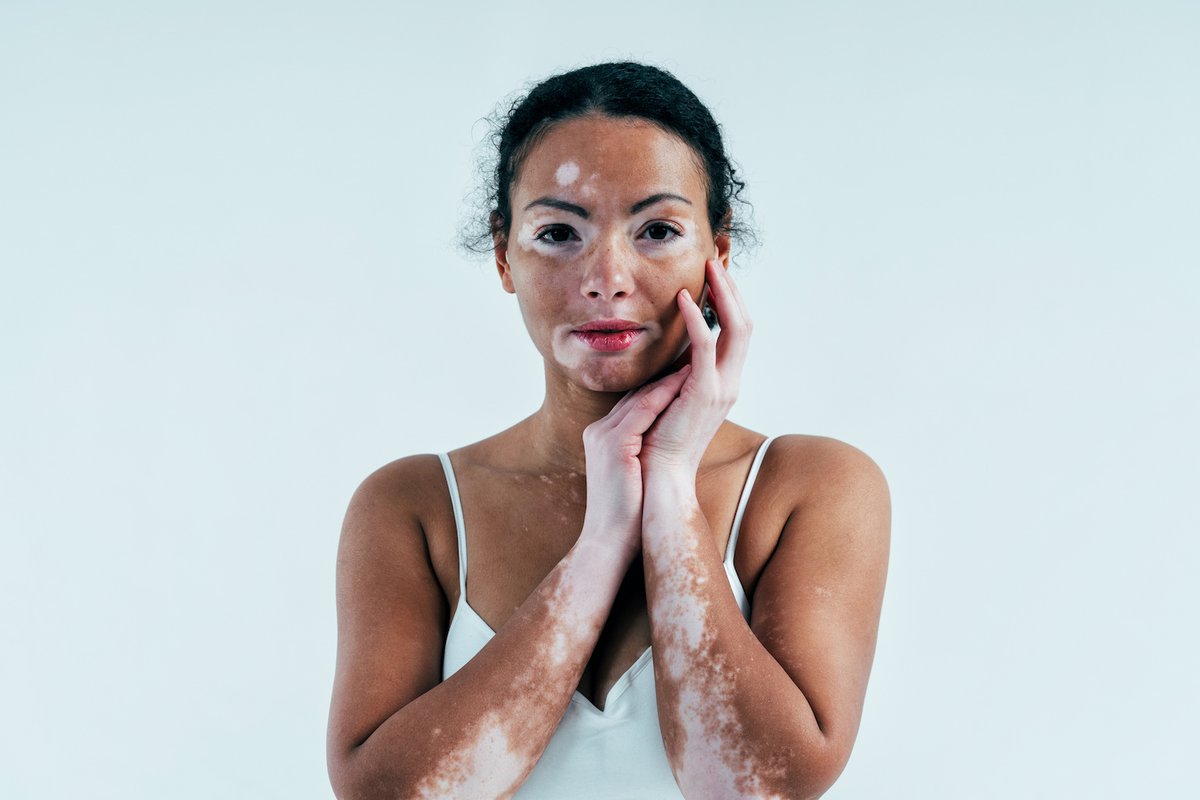 Practical Derm tweet media