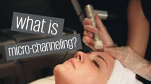 How long does Microchanneling last? skinntonic.com/microchannelin… #microchanneling #skincare #acne #wrinkles