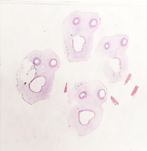 CollinsRebec's tweet photo. Bohemian umbilical cord sections. Thunderbolt and lightning, very, very frightening me!
#PediPath https://t.co/iSRzZx3YAs