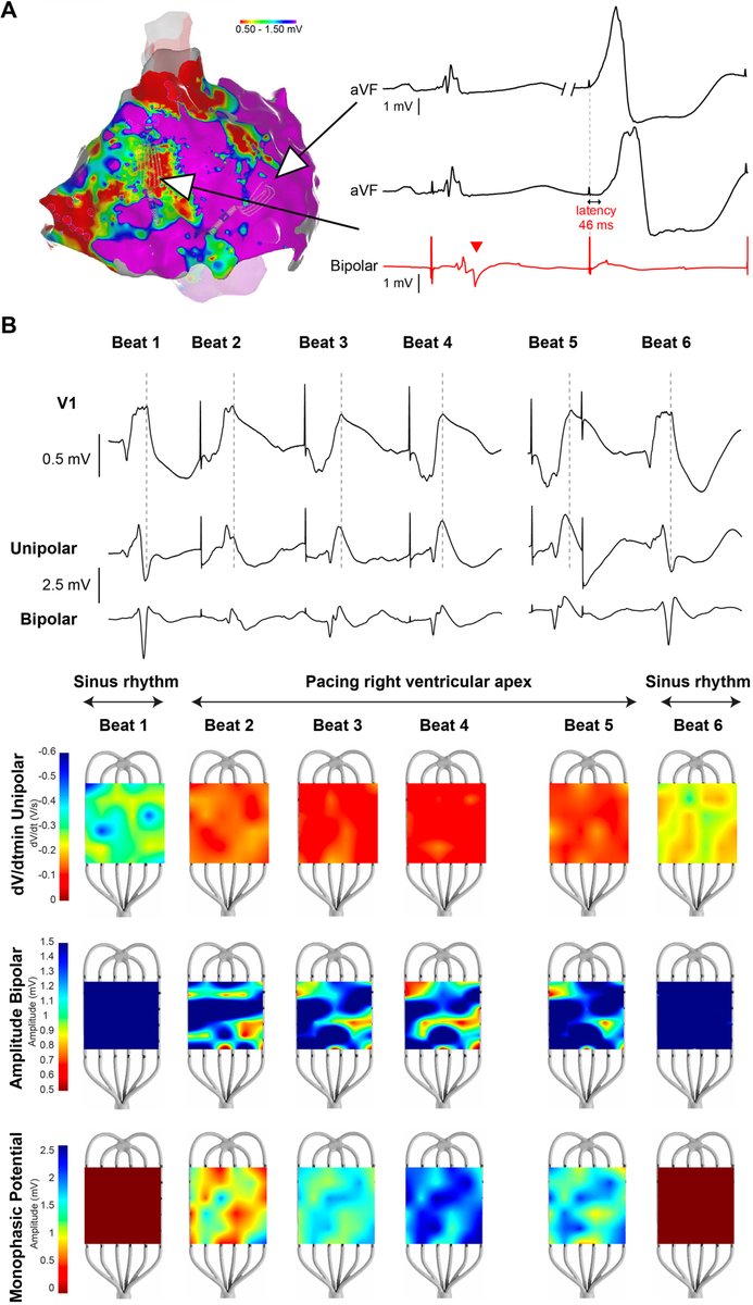 HeartRhythm tweet media