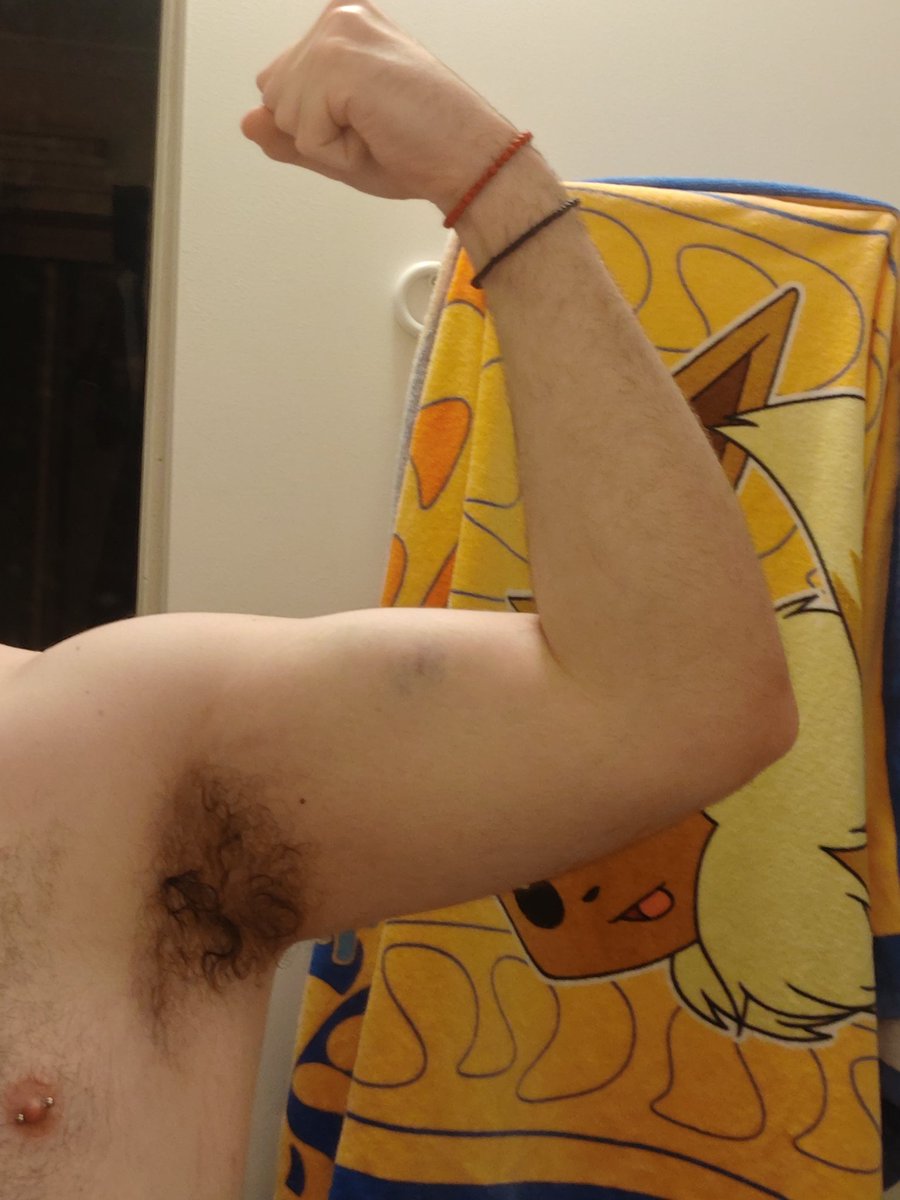 ShadowDaPup's tweet photo. puppy's first muscle-tear bruise! started going to the gym, and while this was only the second session, already loving the grind 🐶💕 #pup #gaypup #puphood #chubbypup #humanpup https://t.co/Vjn1jzdq9Q