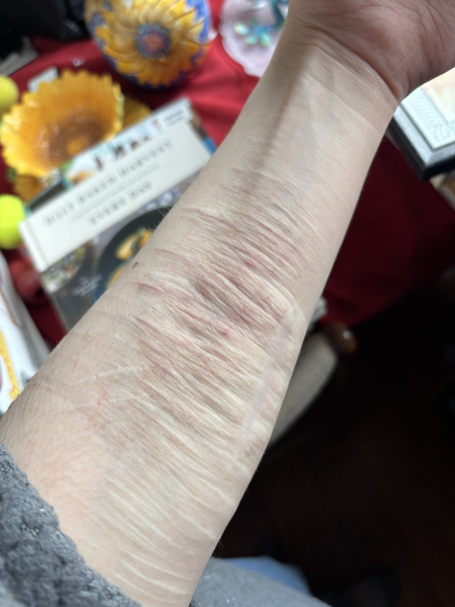 Violetsilenced's tweet photo. lmao my arm looks so wrinkly https://t.co/LANS7Exg0b