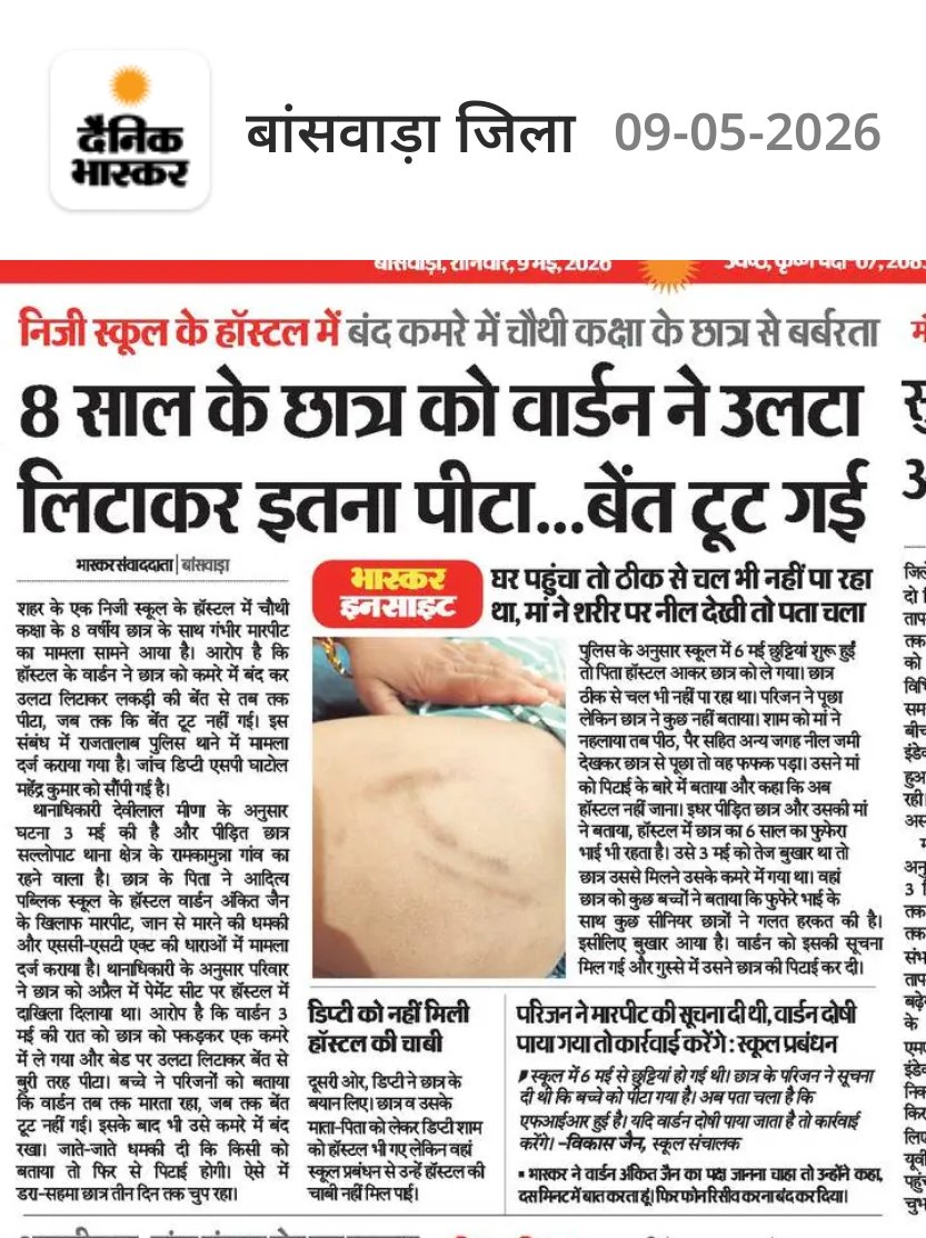 KANTILALRAYKWAL's tweet photo. बांसवाड़ा में 8 साल के मासूम छात्र के साथ हॉस्टल में हुई बर्बरता इंसानियत को शर्मसार करती है।
एक बच्चे को बंद कमरे में बेरहमी से पीटना सिर्फ अपराध नहीं, व्यवस्था पर सवाल है। दोषी वार्डन पर सख्त कार्रवाई हो और बच्चे को न्याय मिले। @RajPoliceHelp @BanswaraPolice @Jitendra_Hatwal https://t.co/sJ0HHoEDAH