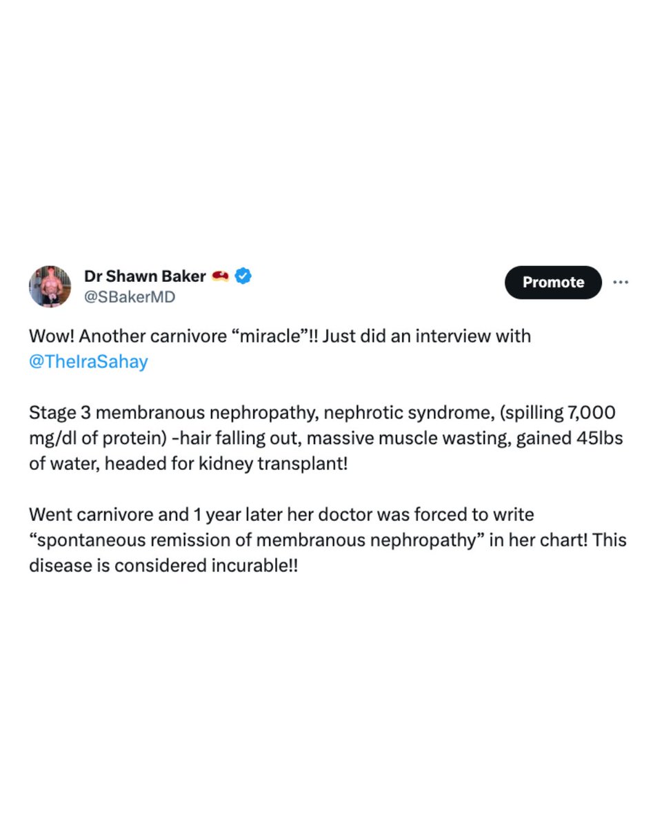 Dr Shawn Baker 🥩 tweet media
