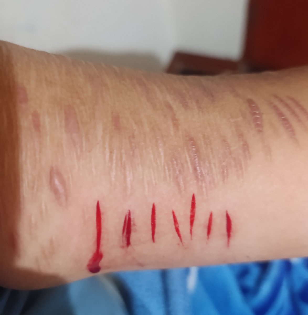 cortándome porq soy un gordo feo