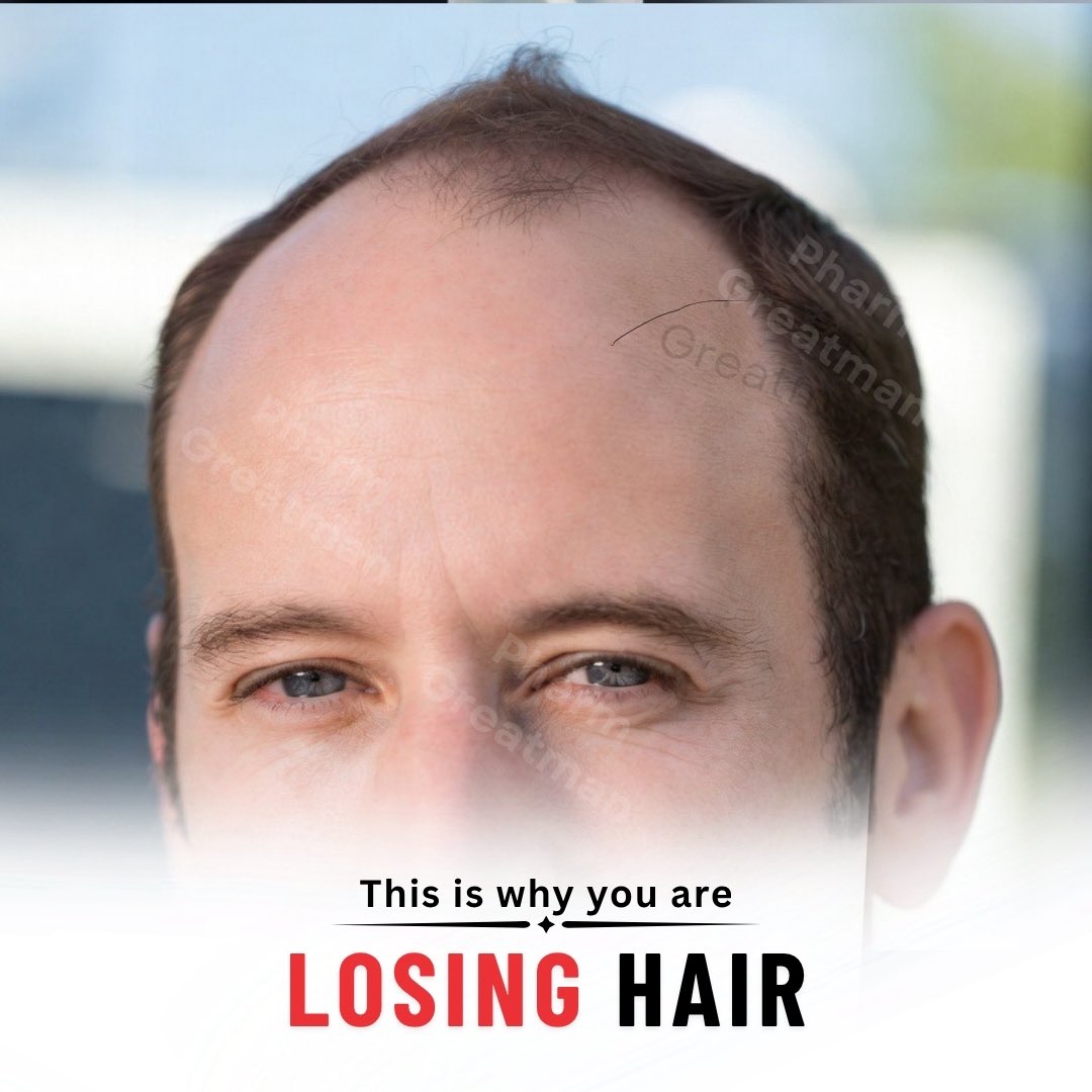 OGreat6's tweet photo. WHY YOU ARE LOSING YOUR HAIRLINE

Your hairline is not “just aging.”

There are several reasons why your hair recedes. The earlier you understand the cause, the better your chances of slowing it down.

Learn them and what to do on this thread
Check my comments below 👇🏾 
Bookmark https://t.co/nmPxz383b0