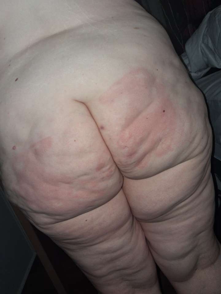 Memewiththacake's tweet photo. The part of being so damn pale you get FULL HANDPRINTS! https://t.co/pX5oYt8XBY