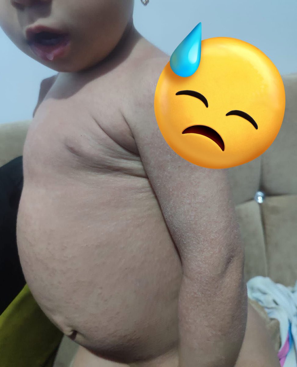 My innocent baby Ghazal is suffering from scabies. 😭😫

gofund.me/62fb9062d