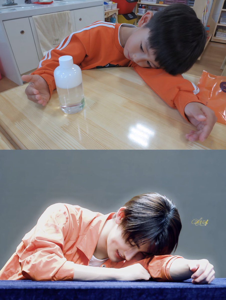 가슴에우동국물쏟음