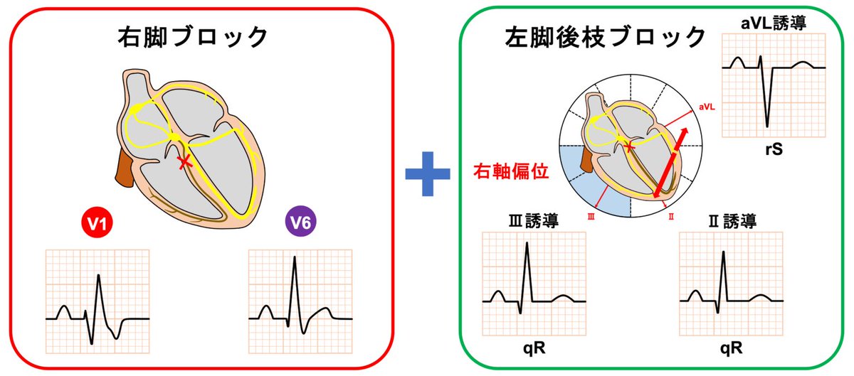 心電図.com tweet media