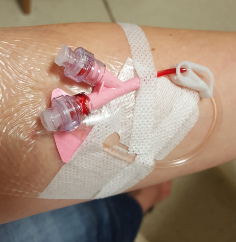 EmpodCat's tweet photo. Nou #MenysésMés basat en una recomanació del Things We Do for No Reason™, us expliquem  que no es recomana mantenir de forma rutinària un accés venós en els  pacients hospitalitzats. 

https://t.co/YwsrA1eFDk https://t.co/taQ8ukoOFR