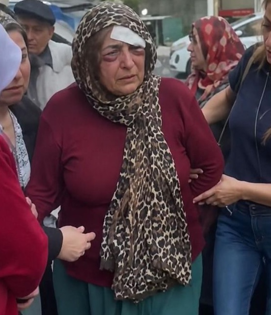 bosunatiklama's tweet photo. İstanbul'da kızını silahla vuran damadını öldüren kayınvalide: 

"Ben anneliğimi yüreğimle yaptım, çocuklarımı korudum." https://t.co/Vpax61m6uZ