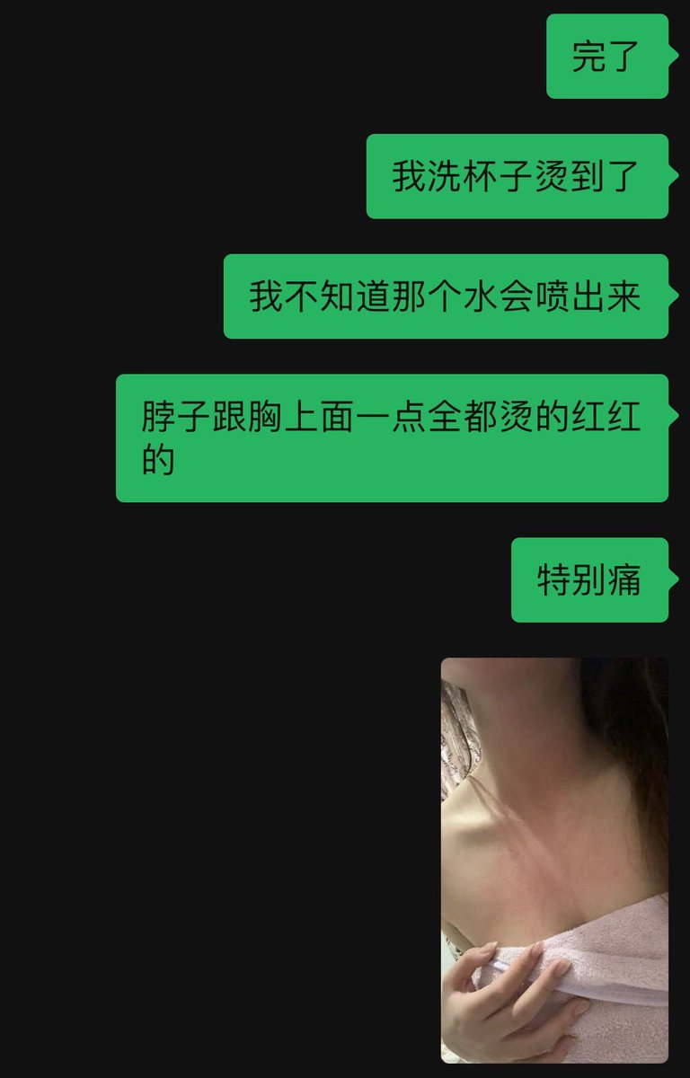 chenqi0806's tweet photo. 宝宝痛 https://t.co/FOCwsxjs7M