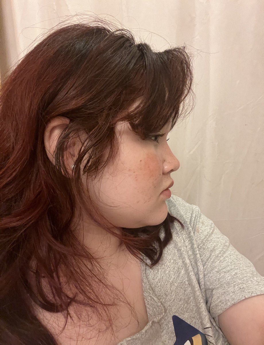 islifesunshine's tweet photo. dropped 60 lbs and here’s my face difference https://t.co/5aPHzGBZNw