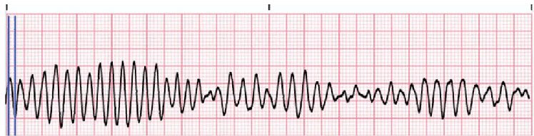 CardiovascularCorner tweet media