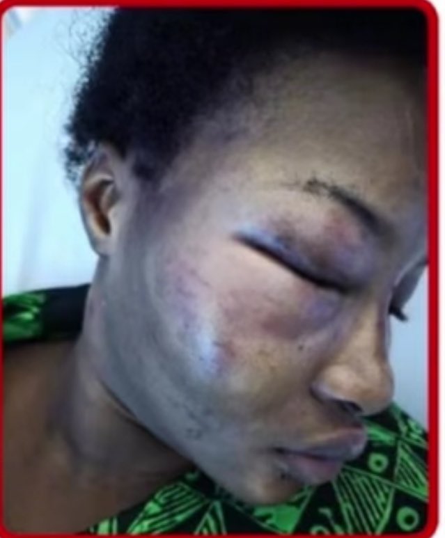 BBNaijagistplug's tweet photo. Ayra Starr was right 🥺

Quick recovery ilebaye 🙏
#BBNaija https://t.co/IZNmdq0TU8