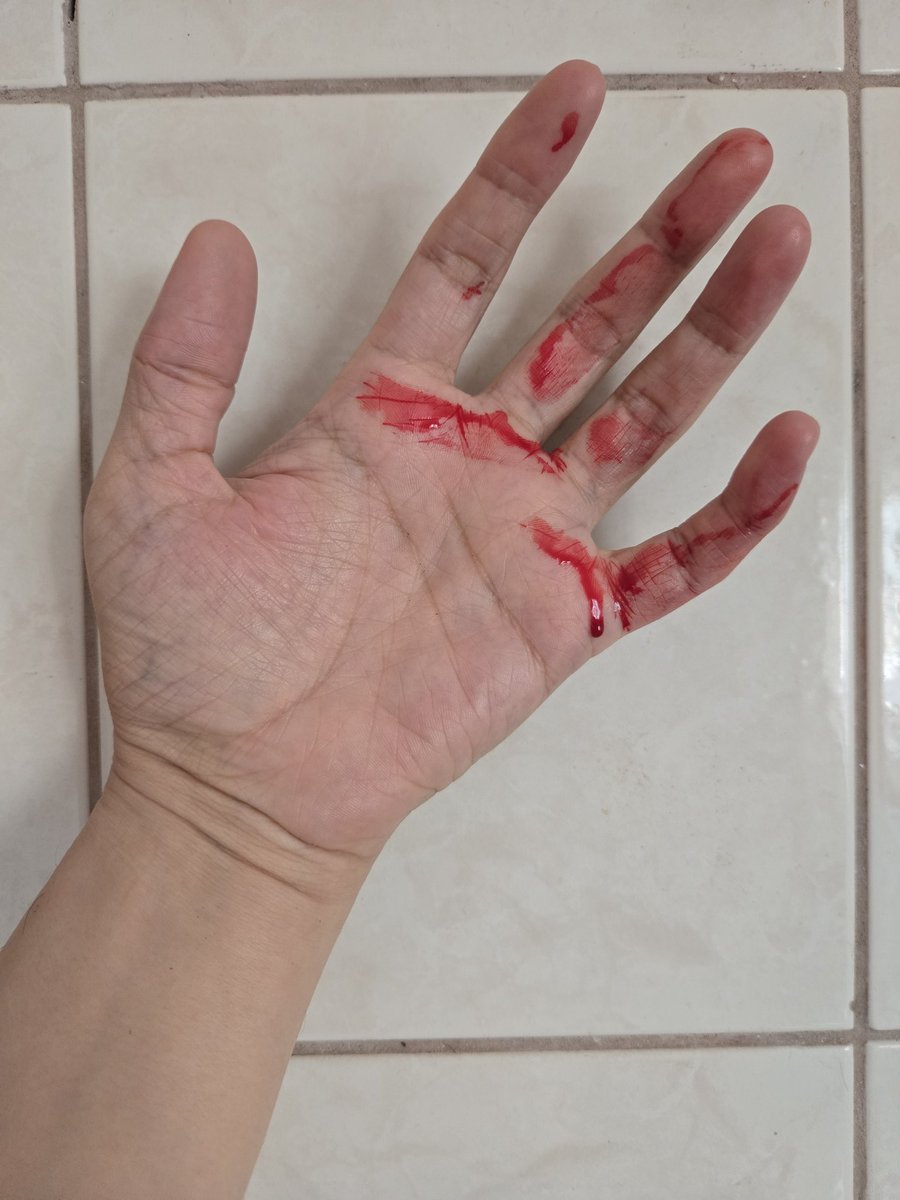 issonuncatemfim's tweet photo. faz tanto tempo que não posto nada do meu sangue, não que todo dia eu não sangre https://t.co/HrDfHBUTzX