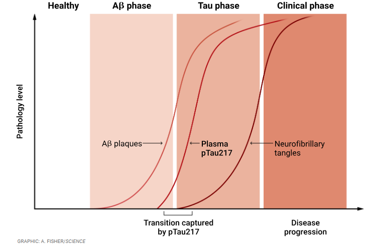 PunMatiram's tweet photo. Tracking the turning point in Alzheimer’s disease
https://t.co/H9jax5jLlo https://t.co/grOIWtHLci