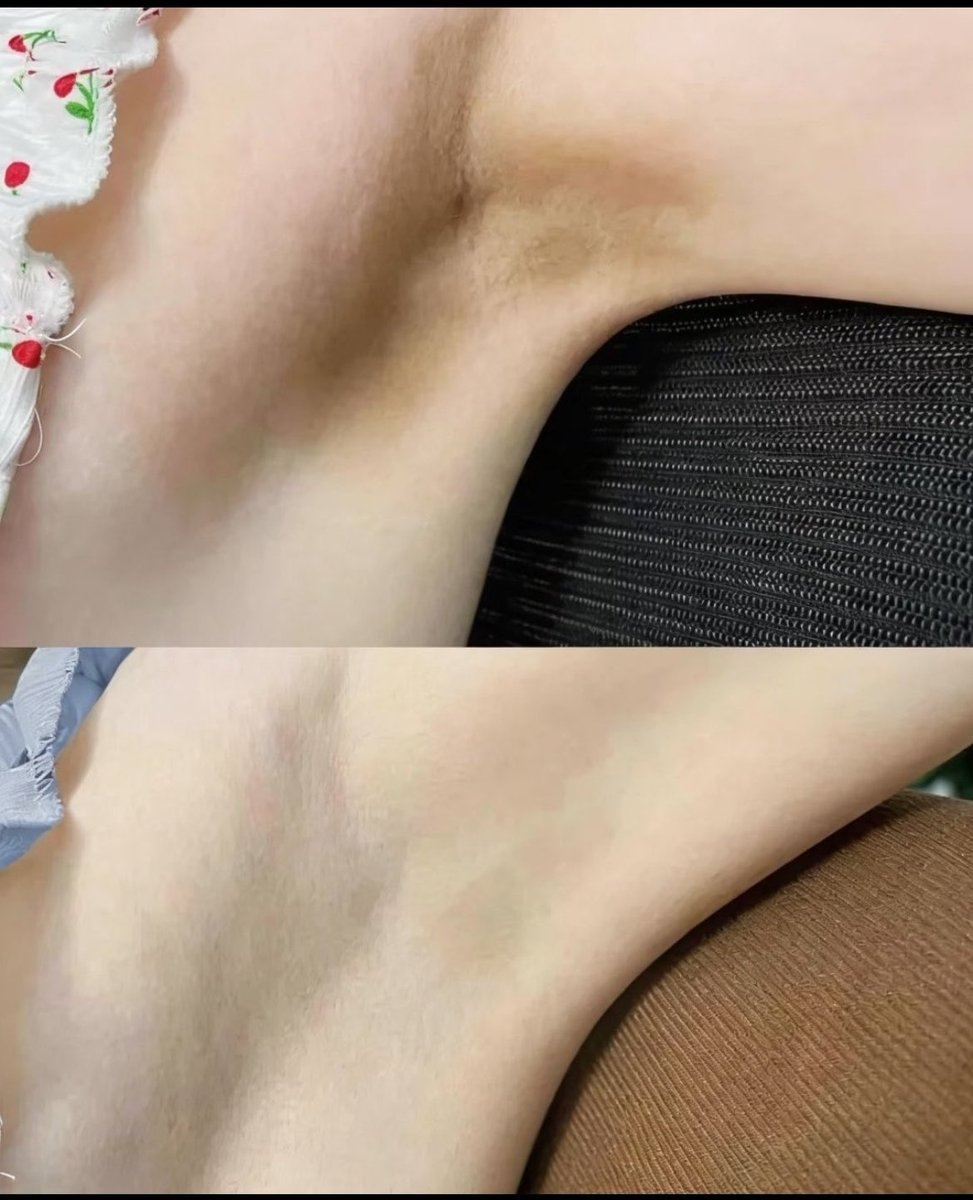 Mavi kutu Nivea + glikolik asit karışımını kim bulduysa gerçekten ödülü hak ediyor...
Deneyimleriniz nasıl ne düşünüyorsunuz ?